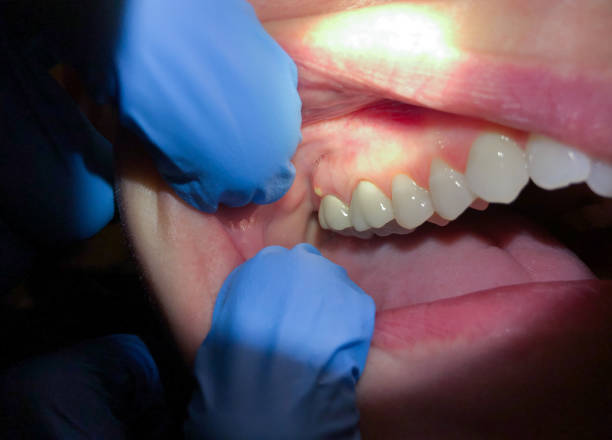 Best Emergency Gum Pain Relief  in Waynesboro, GA